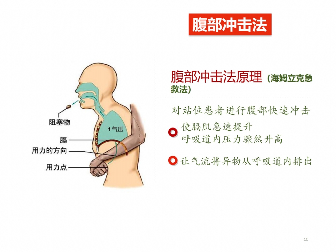 气道梗阻（杨春雷）_09